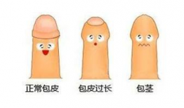 包皮手术视频,专业视频带你了解手术细节